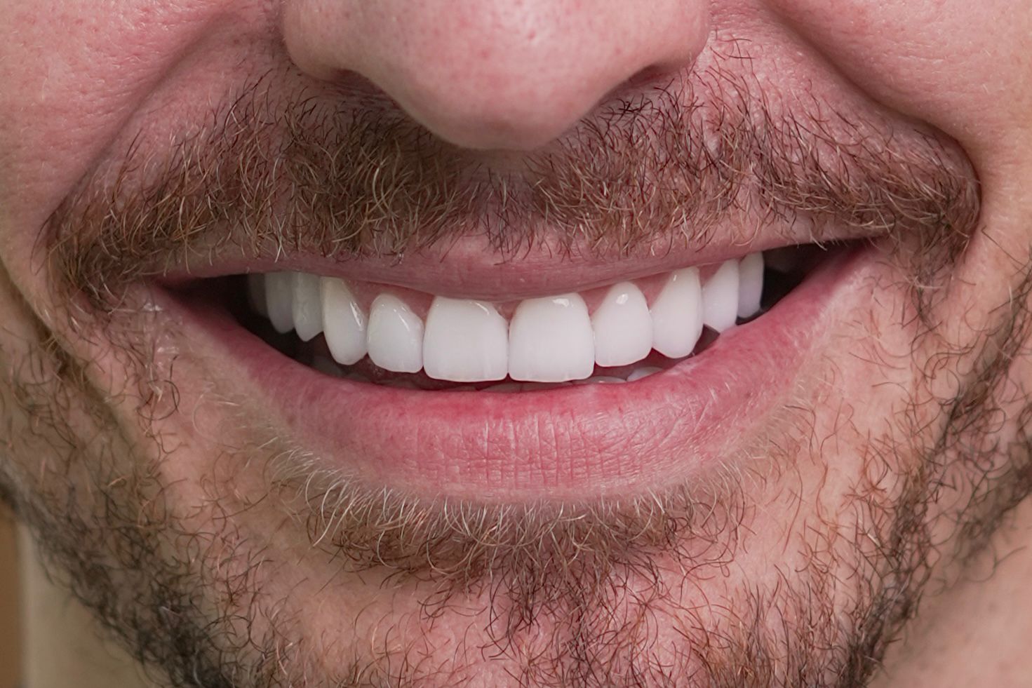Cosmetic Dentistry